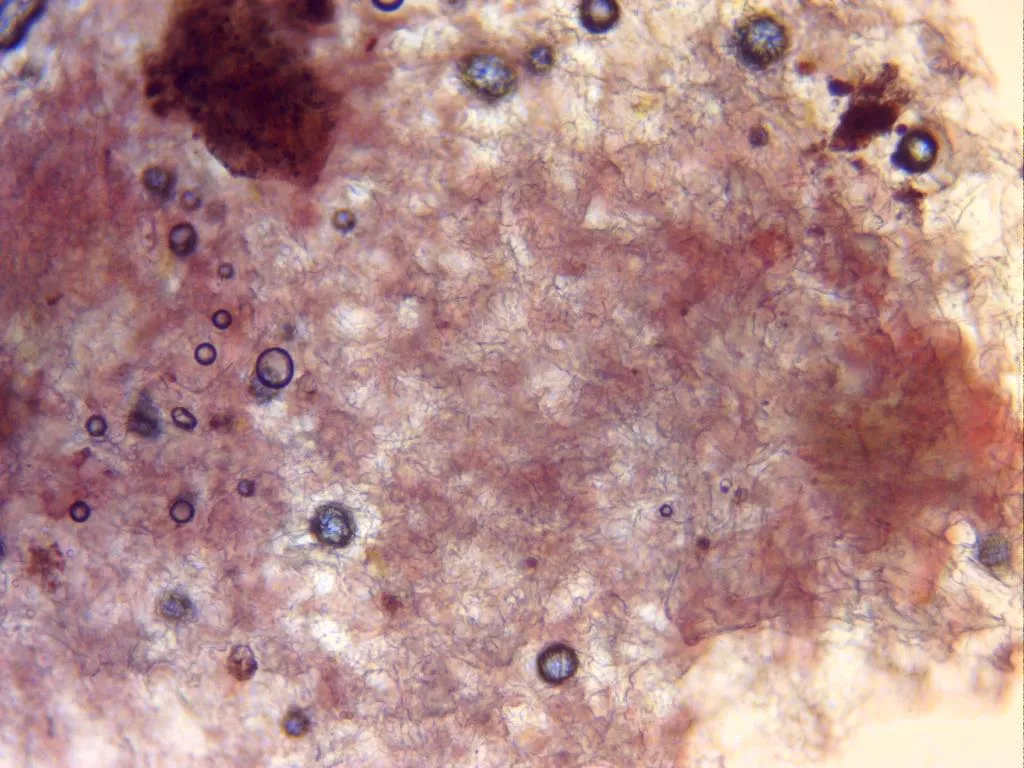 Microscopía de Phyllotopsis nidulans - 13 - Cuticula filamentosa x 100